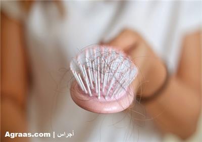 مشاكل تساقط الشعر بعد الولادة علاجات لتغذية شعرك